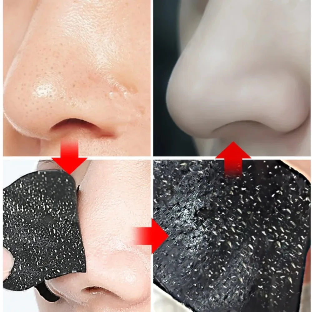 10-50pcs Nose Strips For Blackheads Acne Removal Instant Pore Unclogging Mask Deep Cleansing Nose Clean Patch Beauty Skin Care
